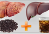 You Are Slowly Damaging Your Liver When Doing These 7 Things