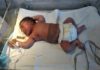 Failing Heart: Journalist appeals for N7.5m aid to save life of 9 weeks old baby