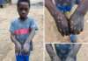 Police urged to probe alleged branding of child domestic worker in Benue